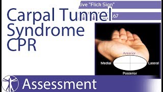 Wainner Clinical Prediction Rule CPR  Carpal Tunnel Syndrome CTS [upl. by Ahsym]