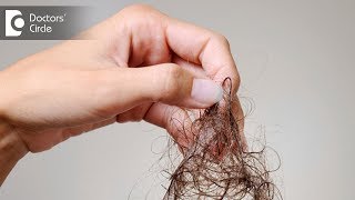 What are causes of severe hair fall like 100 strands daily  Dr Nischal K [upl. by Kerwinn]