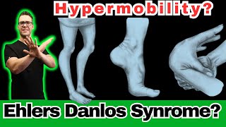 Ehlers Danlos Syndrome Hypermobility Symptoms Diagnosis amp Test [upl. by Manup]