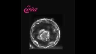 Embryo Development Day 5 Using The Eeva Test [upl. by Eynobe]