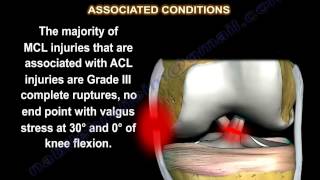 Medial Collateral Ligament injury  MCL Injuries  Everything You Need To Know  Dr Nabil Ebraheim [upl. by Sadoff]