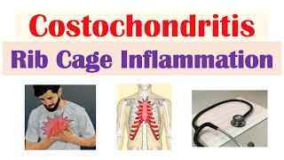 Costochondritis Rib Cage Inflammation  Causes Symptoms Diagnosis Treatment [upl. by Iron116]