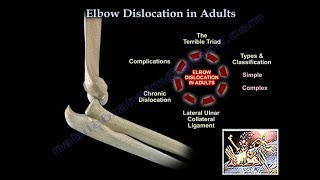 Elbow Dislocation In Adults  Everything You Need To Know  Dr Nabil Ebraheim [upl. by Htiffirg]