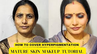 Hyperpigmentation CoverUp TutorialquotFlawless party makeup  Namrta’s beauty diaries ツ [upl. by Laetitia]