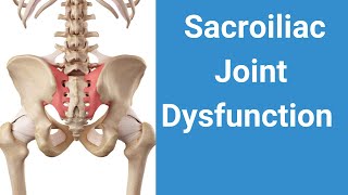 Sacroiliac Joint Dysfunction How To Resolve [upl. by Meridith134]