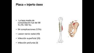 Tratamiento pseudoartrosis de Húmero [upl. by Tahp203]