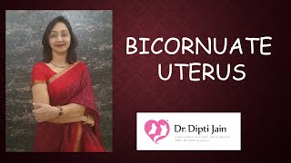 BICORNUATE UTERUS [upl. by Ylam924]