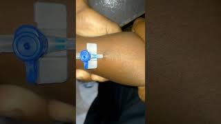 IV Cannulation Procedure Technique [upl. by Simdars]