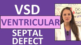 Ventricular Septal Defect Nursing  NCLEX Pediatric Congenital Heart Defects [upl. by Paugh592]