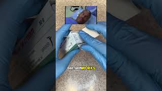 20 secs on daktarin medstudent athletesfoot antifungal [upl. by Airakaz]