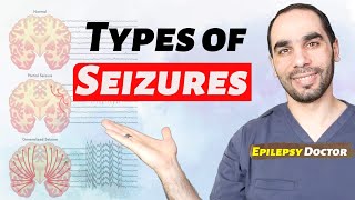 How to know if you have Epilepsy different seizure types [upl. by Lebiram107]