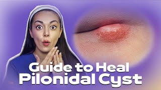 How to Cure PILONIDAL CYST Treatment Causes Effects [upl. by Clarisa890]