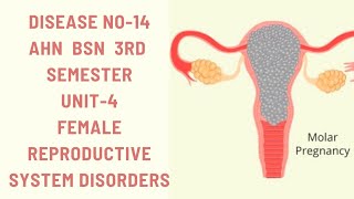 Hydatidiform MoleMolar pregnencyDisease14AHNBSN 3rdsemester Unit4female reproductive disorders [upl. by Artenehs498]