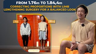 LEG LENGTHENING SURGERY FROM 176 CM TO 1844 CM FOR PROPORTION AND DEFORMITY CORRECTION [upl. by Ohcamac]