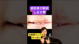 口内炎。何とかしたい🦷stomatitis 口内炎 応急処置 治療 早く治す 歯医者 薬 方法 歯科衛生士 歯科助手 豆知識 生理食塩水 [upl. by Gautea]