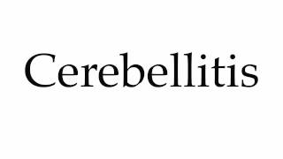 How to Pronounce Cerebellitis [upl. by Seraphine]