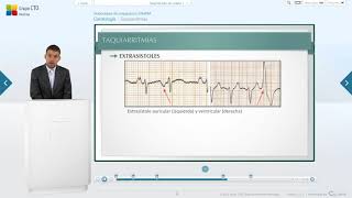 Cardiología  Taquiarritmias VideoClase CTO ENARM [upl. by Esinart80]