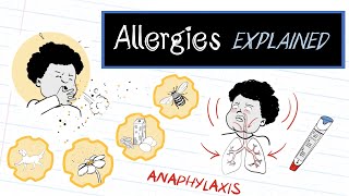 What are Allergies HealthSketch [upl. by Yelad993]