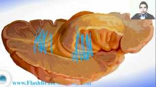 Lateral Ventricle and Insule  Brain Anatomy [upl. by Euginom]