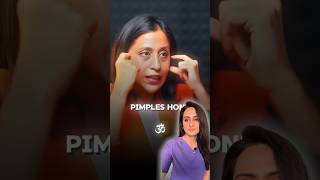 Acne face mapping  can acne show problems in internal organs  dermatologist comments [upl. by Llehcnom]