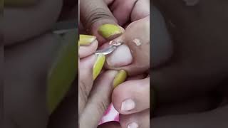 cleaning toenail videos pedicure nails satisfying subscribe [upl. by Einttirb]