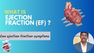 What is ejection fraction EF of heart  Low ejection fraction symptoms  How to improve low EF [upl. by Neesay]