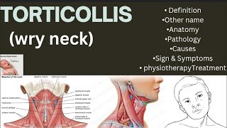 Torticollis wry neckDefinition Other nameAnatomyPathology CausesSignampSymptomsPhysiotherapy [upl. by Luhey]