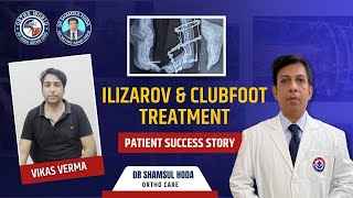 Vikash Vermas Ilizarov amp Clubfoot Treatment Success Story with Dr Shamsul Hoda [upl. by Auqinom806]