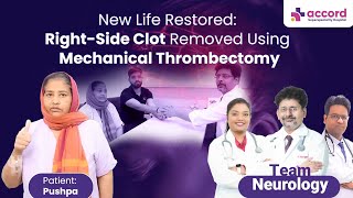 🌟 New Life Restored with Mechanical Thrombectomy 🌟  Dr Rohit Gupta [upl. by Drofla566]