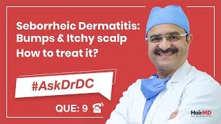 How To Treat Seborrheic Dermatitis कैसे seborrheic का इलाज करे  AskDrDc Ep 9  In HINDI [upl. by Hayton]