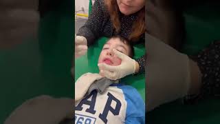 Oral Stimulation Botox in Parotid Gland Cerebral Palsy Speech Therapy [upl. by Nagam]