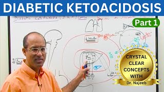 Diabetic Ketoacidosis  Symptoms  Causes  Diagnosis  Part 1 👨‍⚕️ [upl. by Pond]