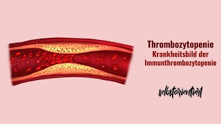 Thrombozytopenie amp Morbus Werlhof Immunthrombozytopenie einfach erklärt  Symptome  Ursachen [upl. by Ahtael]