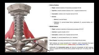 Mechanism of Thoracic Outlet Syndrome Anatomical Approach [upl. by Turino]