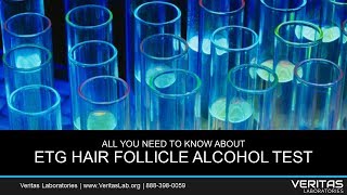 EtG Hair Follicle Alcohol Test All You Need to Know FAQ [upl. by Wavell747]