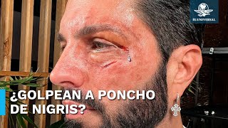 Poncho de Nigris aparece golpeado y sorprende a usuarios en redes [upl. by Soni]