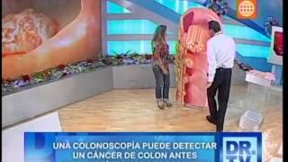 Cáncer de colon  Síntomas y tratamiento [upl. by Erehc]