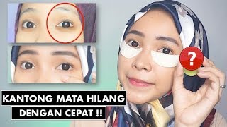 TIPS MENGHILANGKAN KANTONG MATA MASKER BIKIN SENDIRI GAMPANG  DIY EYE MASK DARK CIRCLE [upl. by Skipper40]