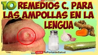 10 Remedios Caseros para las Ampollas en la Lengua [upl. by Mindi]