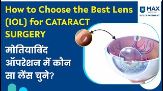 Which Lens IOL to choose for Cataract Surgery  Price Choices amp Benefits of IOL Lenses [upl. by Lew]