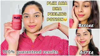 Get that facial like glow in just 10 minutes 💯 Plix Pomegranate Peeling Solution [upl. by Oznarol]