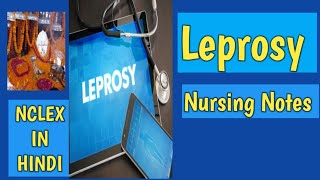 LEPROSYNURSING NOTESAnitaSharmaGyan NCLEX IN HINDI [upl. by Columbine]