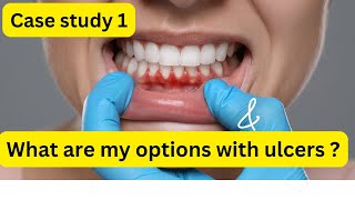 Mouth Ulcers amp Bleeding Gums The Solutions You Need [upl. by Ripley]