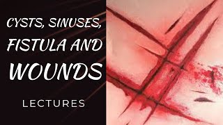 CYSTS SINUSES FISTULA WOUNDS lecture 4 WOUNDS classification healing phases types [upl. by Marley843]