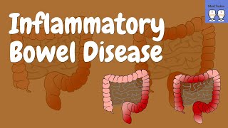 Mayo Clinic Explains Ulcerative Colitis [upl. by Gradey]