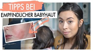 NEURODERMITIS EKZEM BEI BABIES I TIPPS BEI EMPFINDLICHER BABYHAUT  EILEENA [upl. by Snowber]