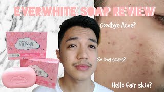 EVERWHITE SOAP REVIEW  Pimple marks remover [upl. by Sile377]