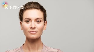 Kleresca® Skin Rejuvenation [upl. by Cailean968]