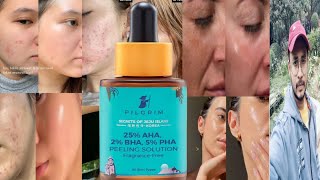 Pilgrim 25 AHA 2 BHA 5 PHA Peeling Solution  Honest Review [upl. by Ahseenal]