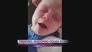 Whooping cough video goes viral [upl. by Aibonez83]